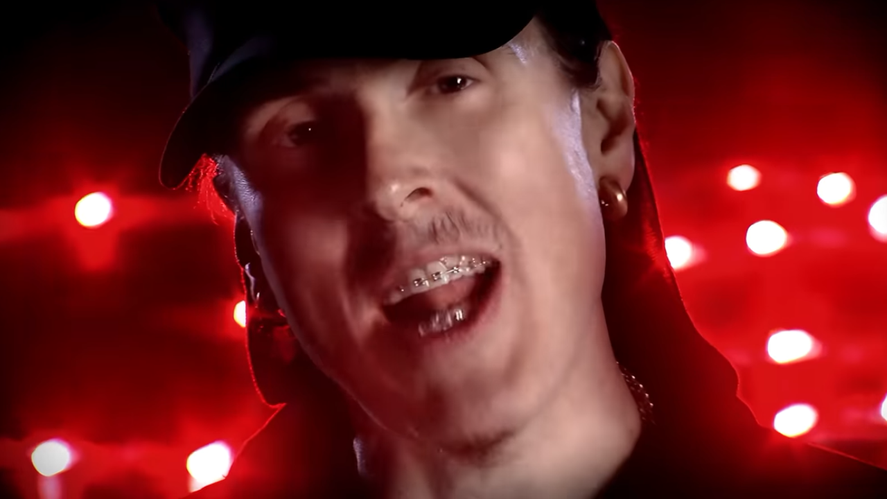 Image of Weird in braces from music video for "White & Nerdy"